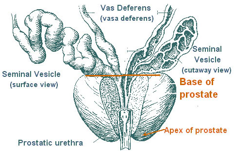 Prostate Cancer Anatomy